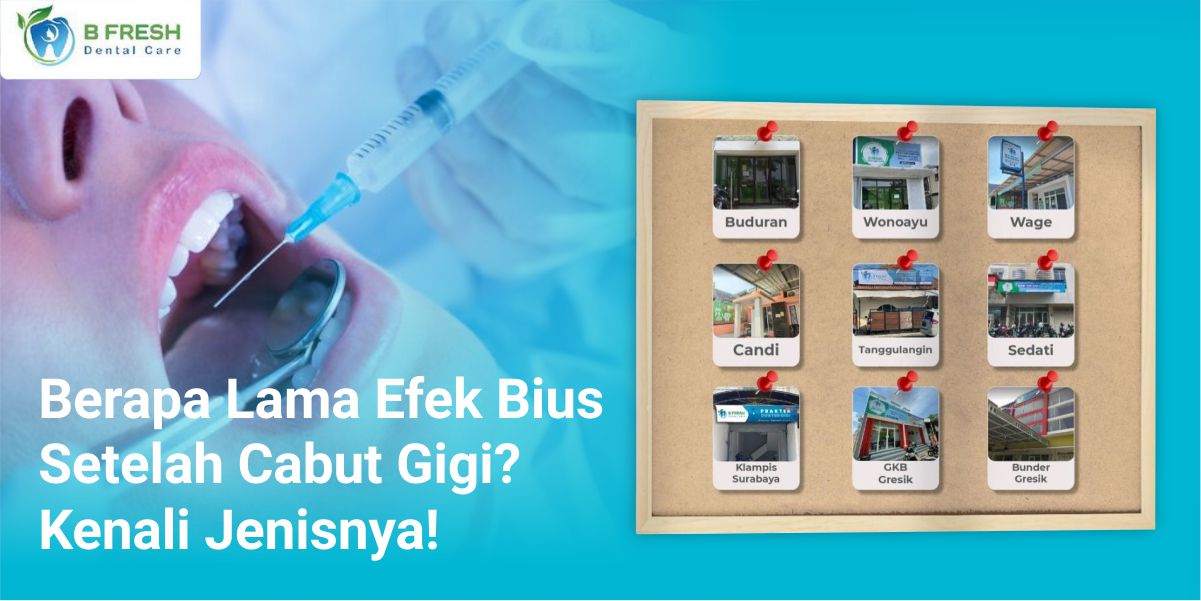 Berapa Lama Efek Bius Setelah Cabut Gigi? Kenali Jenisnya!